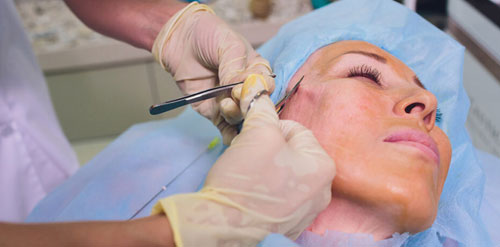 Cancer Plastic and reconstructive surgery in Nagpur